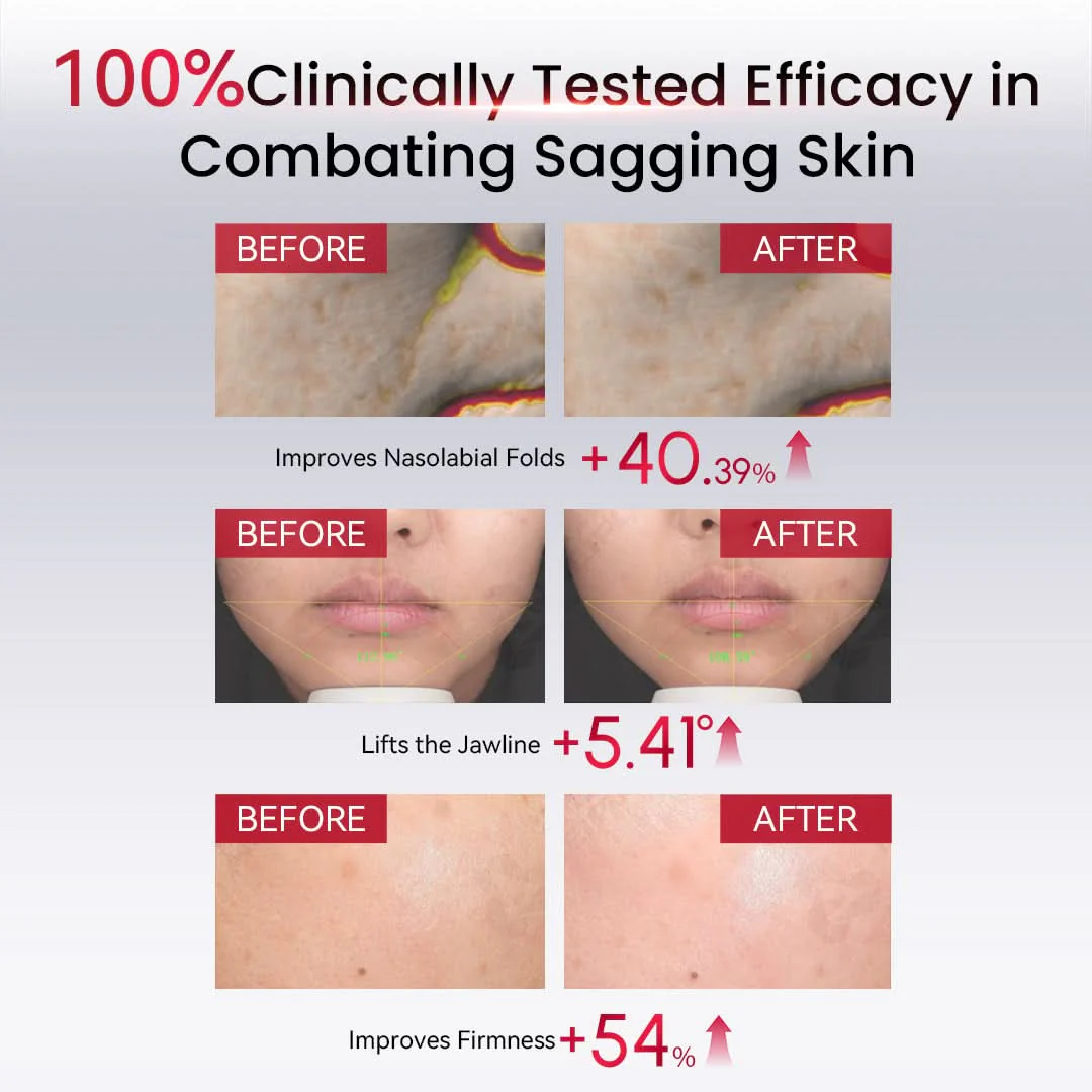 AMIRO PDRN Firm Radiance Boosting Serum - Image 5
