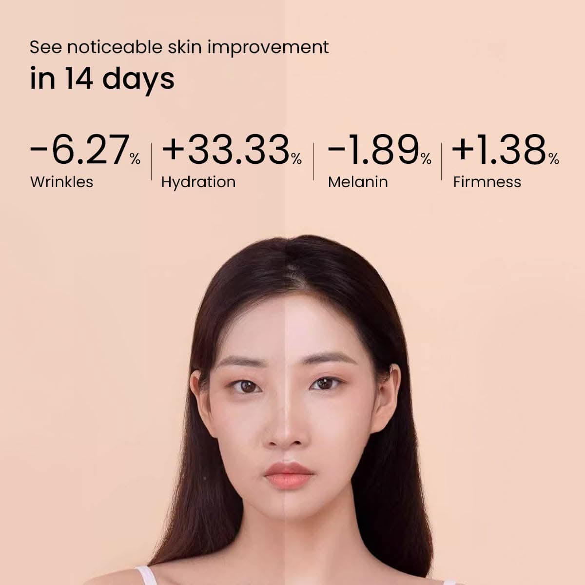 Ion Skin Rejuvenation Device - Image 3